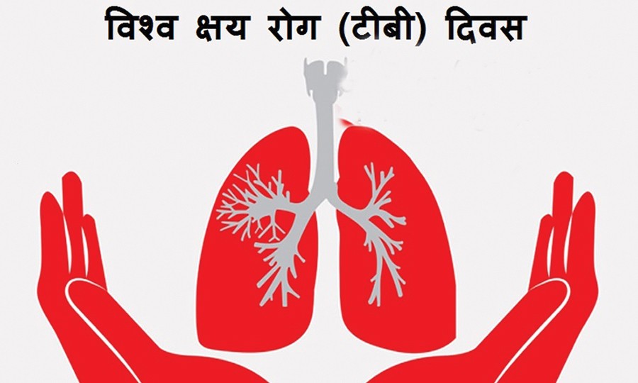 कोराेना भन्दा खतरनाक क्षयरोग : औषधी किन्न पैसा लाग्दैन,उपचारमा हेलचेक्र्याइँ नगराैँ  !