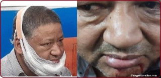 बुटवलको मतगणनास्थलमै कांग्रेस उम्मेदवारमाथि आक्रमण,कुमार केसी घाइते !