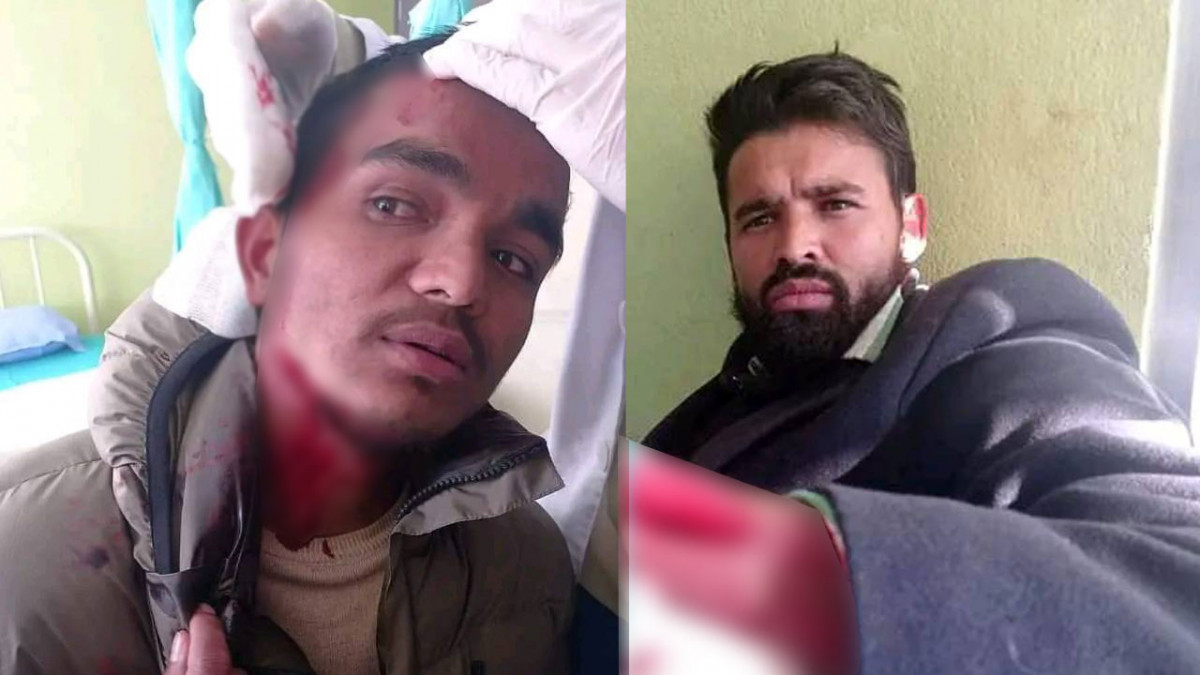 आरआर क्याम्पसमा मदन भण्डारीमाथि खुकुरी प्रहार,३ विद्यार्थी नेता घाइते