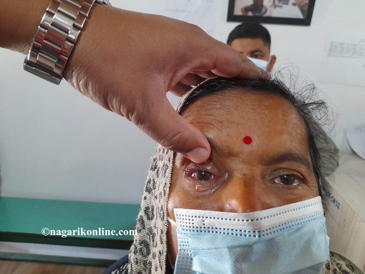 डेढो आँखाको सफल शल्यक्रियाले  नौमतीको खुसी फर्कियो !
